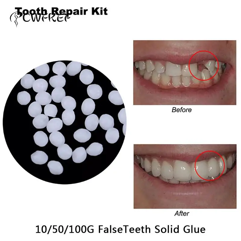 10g Teeth And Gap Falseteeth Solid Glue Resin FalseTeeth Solid Glue Temporary Tooth Repair Set Denture Adhesive Teeth Dentist
10g Teeth And Gap Falseteeth Solid Glue Resin FalseTeeth Solid Glue Temporary Tooth Repair Set Denture Adhesive Teeth Dentist