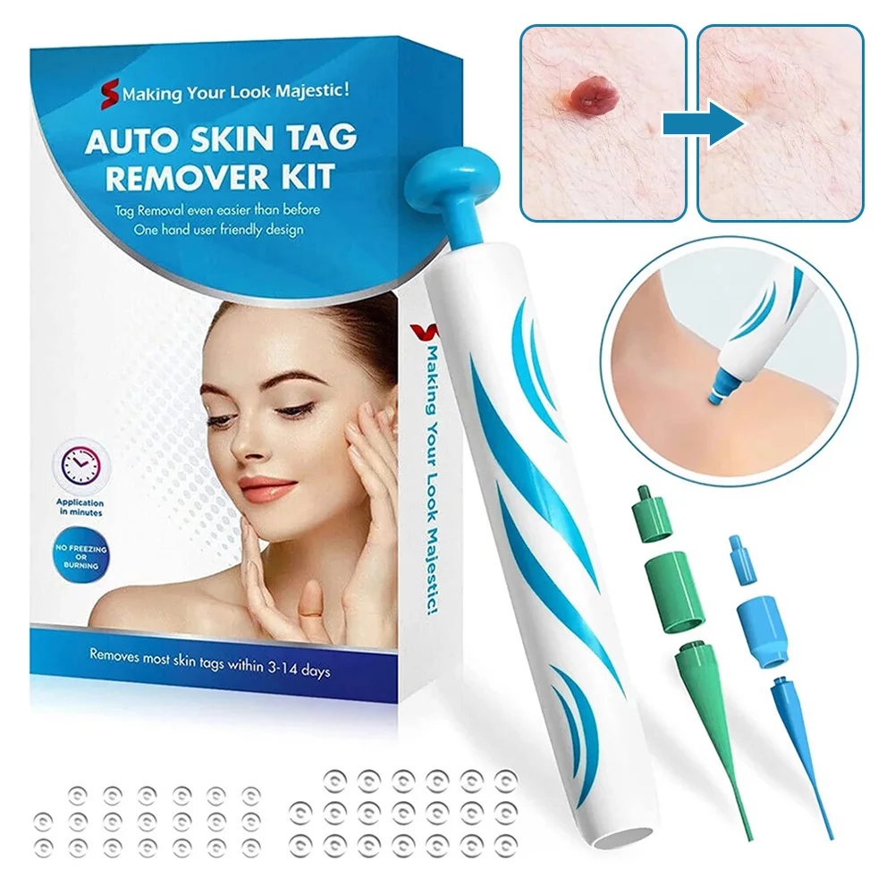 Auto Skin Tag Remover Kit For 2-8mm Skin Tags Painless Wart Mole Corn Remover Device Face Body Beauty Tools
Auto Skin Tag Remover Kit For 2-8mm Skin Tags Painless Wart Mole Corn Remover Device Face Body Beauty Tools