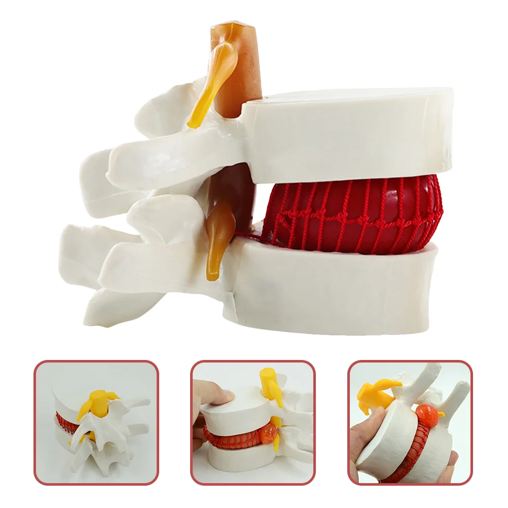 Mannequin Intervertebral Disc Model Lumbar Spine Teaching Human White Demonstrating Anatomical Herniation
Mannequin Intervertebral Disc Model Lumbar Spine Teaching Human White Demonstrating Anatomical Herniation