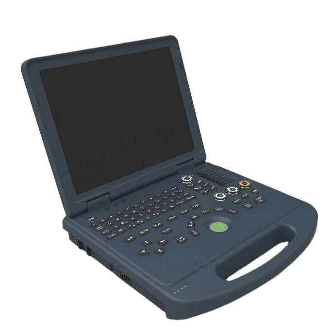 DW-L3 echo Vinno machine portable and laptop color doppler ultrasound products with convex probe 
DW-L3 echo Vinno machine portable and laptop color doppler ultrasound products with convex probe