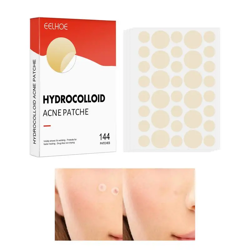 Zit Patch 144pcs Invisible Pimple Spot Patches Hydrocolloid Acnes Spot Pimple Patches Effective Pimples Sticker For Healing
Zit Patch 144pcs Invisible Pimple Spot Patches Hydrocolloid Acnes Spot Pimple Patches Effective Pimples Sticker For Healing