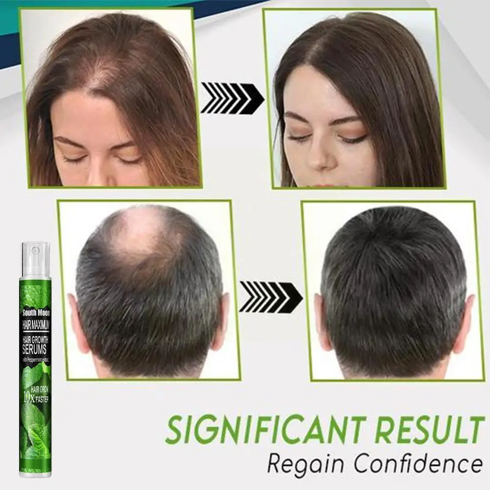 3/1pcs Hair Growth Spray Serum Anti Hair Loss Products Thinning Hair Care Fast Prevent Dry Damaged Grow Repair I2w4
3/1pcs Hair Growth Spray Serum Anti Hair Loss Products Thinning Hair Care Fast Prevent Dry Damaged Grow Repair I2w4