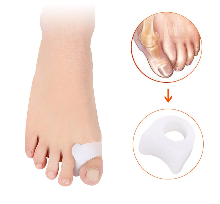 Multi-size Silicone Toe Separator Correction Pad Thumb Valgus Bunion Guard Foot Care Tools Toes Separators Feet Finger Protector
Multi-size Silicone Toe Separator Correction Pad Thumb Valgus Bunion Guard Foot Care Tools Toes Separators Feet Finger Protector