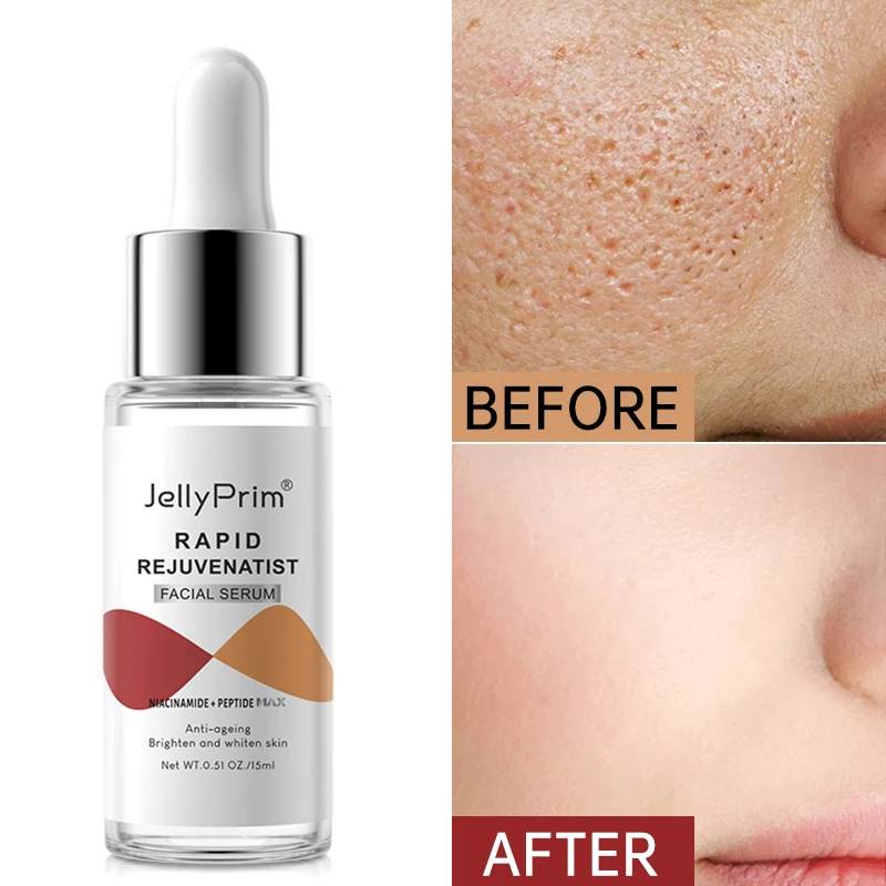 Dark Spots Whitening Niacinamide Serum Skin Care For Glowing Skin Hyaluronic Acid Collagen Pore Reduction Facial Serum Beauty
Dark Spots Whitening Niacinamide Serum Skin Care For Glowing Skin Hyaluronic Acid Collagen Pore Reduction Facial Serum Beauty
