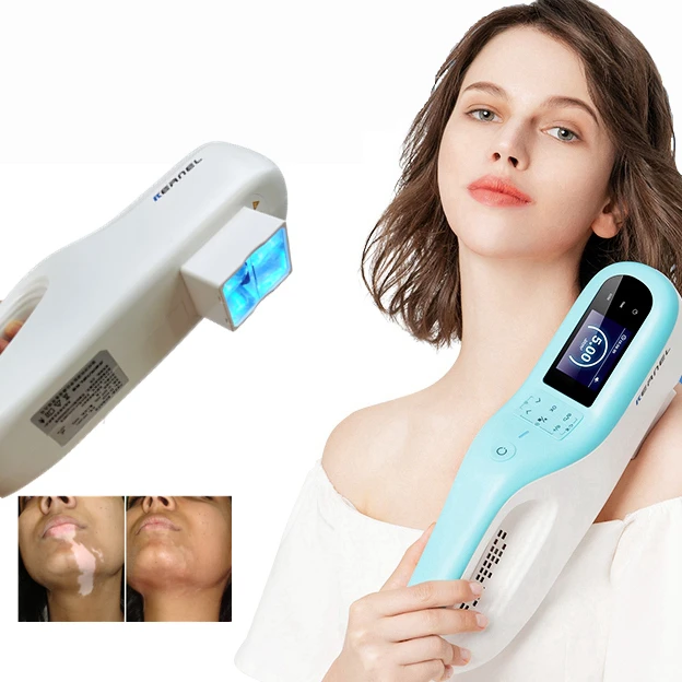 

Kernel factory supply KN-5000E portable 308nm Excimer laser for psoriasis vitiligo targeted UV phototherapy treatment