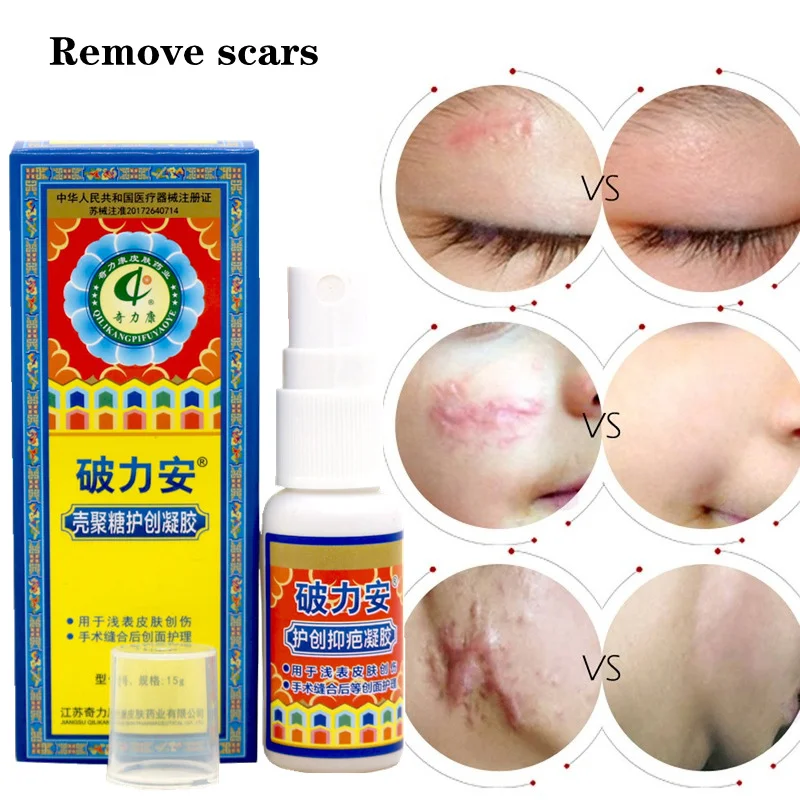 Acne Scar Treatment Gel Removal Stretch Marks Repair Surgical Burn Scars Smooth Skin Surgical Wound Healing Body Skin Care 15g
Acne Scar Treatment Gel Removal Stretch Marks Repair Surgical Burn Scars Smooth Skin Surgical Wound Healing Body Skin Care 15g