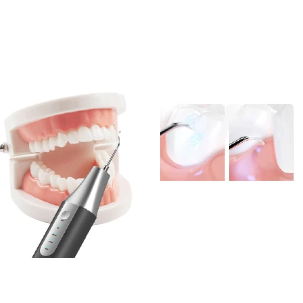 Portable Oral Irrigator Collapsible Dental Water Flosser USB Charge Irrigator Dental Water Floss Tip Teeth Cleaner
Portable Oral Irrigator Collapsible Dental Water Flosser USB Charge Irrigator Dental Water Floss Tip Teeth Cleaner