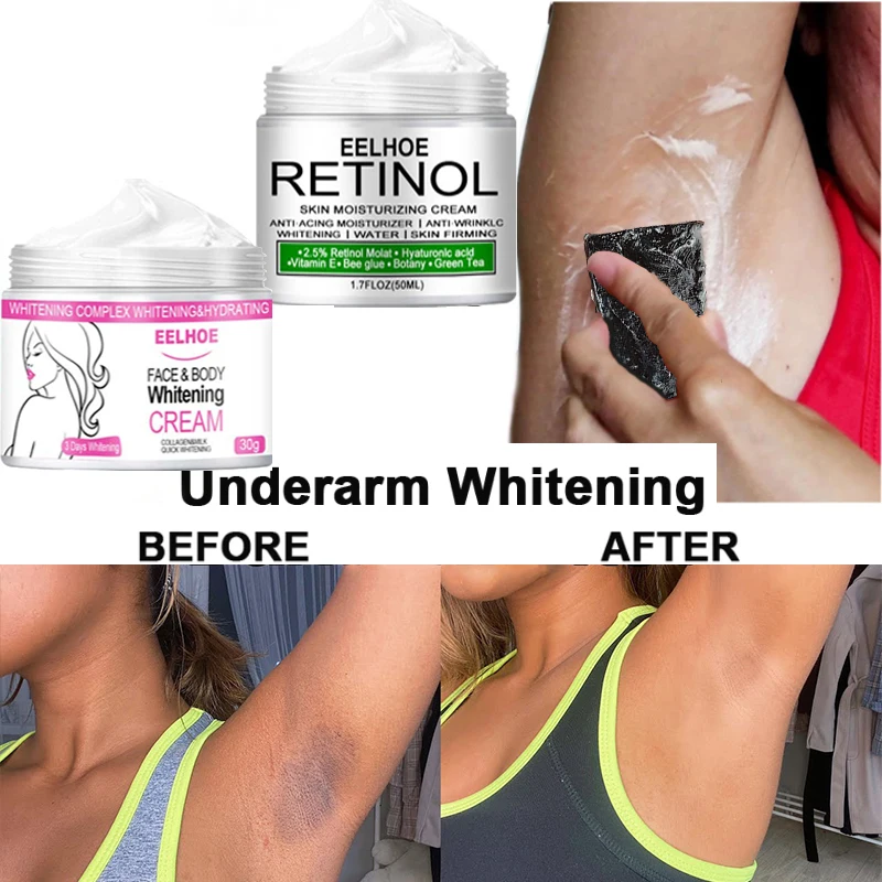 Body Whitening Cream Private Parts Underarm Bleaching Serum Remove Melanin Pigmentation Brighten Inner Thigh Intimate Dark
Body Whitening Cream Private Parts Underarm Bleaching Serum Remove Melanin Pigmentation Brighten Inner Thigh Intimate Dark