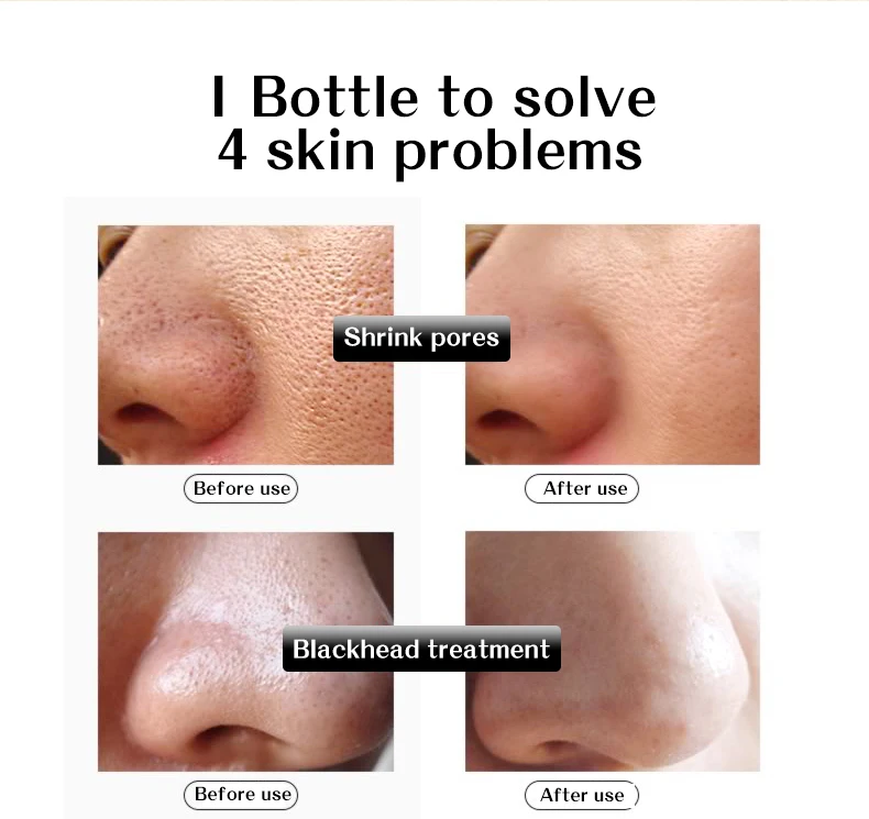 Face Ampoule Hyaluronic Acid Serum Moisturizing Skin Care Hydrating Shrink Pores Anti-aging Wrinkle Liquid TSLM1 
Face Ampoule Hyaluronic Acid Serum Moisturizing Skin Care Hydrating Shrink Pores Anti-aging Wrinkle Liquid TSLM1
