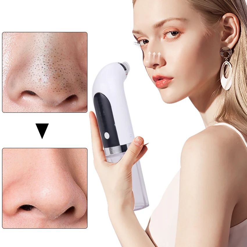 1PC Vacuum Cleaner For Removing Black Pores Acne Removal Removal Usb Charging Water Circulation Facial Cleaning Tool
1PC Vacuum Cleaner For Removing Black Pores Acne Removal Removal Usb Charging Water Circulation Facial Cleaning Tool