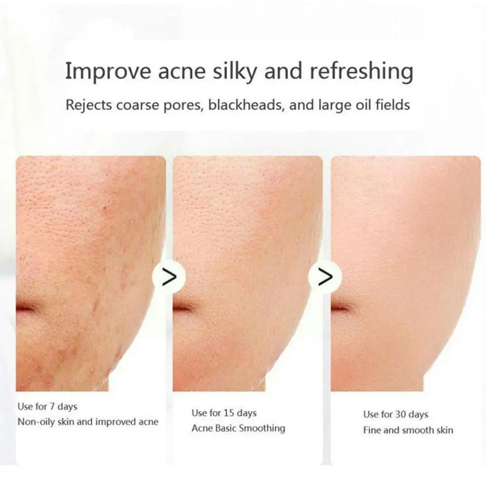 Vova Retinol Anti Wrinkle Face Wash Soap Collagen Firming Aging Pores Anti Puffiness Moisturize Improve Skin Lifting Care S X6r4
Vova Retinol Anti Wrinkle Face Wash Soap Collagen Firming Aging Pores Anti Puffiness Moisturize Improve Skin Lifting Care S X6r4