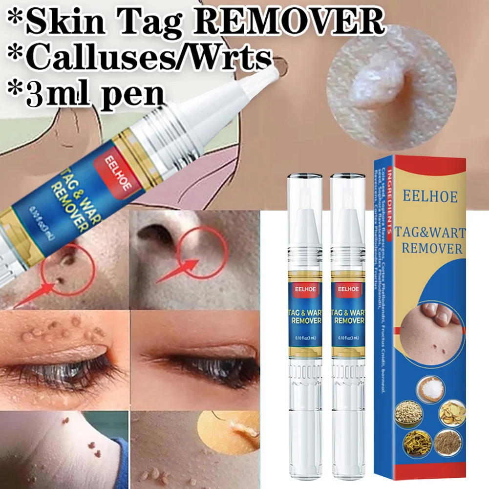 New Skin Tag Remover Liquid Pen Fast Drying Quickly Remove Skin Tags Wart Callus Natural Wart Removal Pen For All Skin Types
New Skin Tag Remover Liquid Pen Fast Drying Quickly Remove Skin Tags Wart Callus Natural Wart Removal Pen For All Skin Types