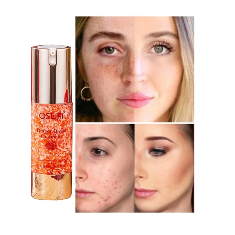 Ganoderma Lucidum Nourishing Beauty Activating Dragon Blood Cream Evenly Skin Tone Finely Pore Brightening Face Repairs Skin
Ganoderma Lucidum Nourishing Beauty Activating Dragon Blood Cream Evenly Skin Tone Finely Pore Brightening Face Repairs Skin
