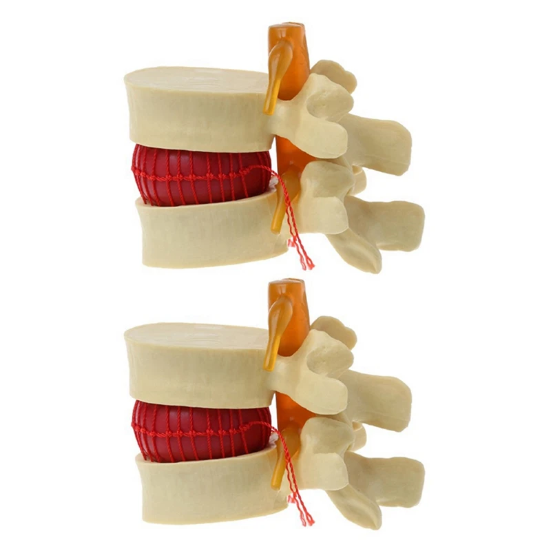 2X Lumbar Vertebrae Model Anatomical Spine Lumbar Disc Herniation Anatomy Teaching Tool Lumbar Vertebrae Model
2X Lumbar Vertebrae Model Anatomical Spine Lumbar Disc Herniation Anatomy Teaching Tool Lumbar Vertebrae Model