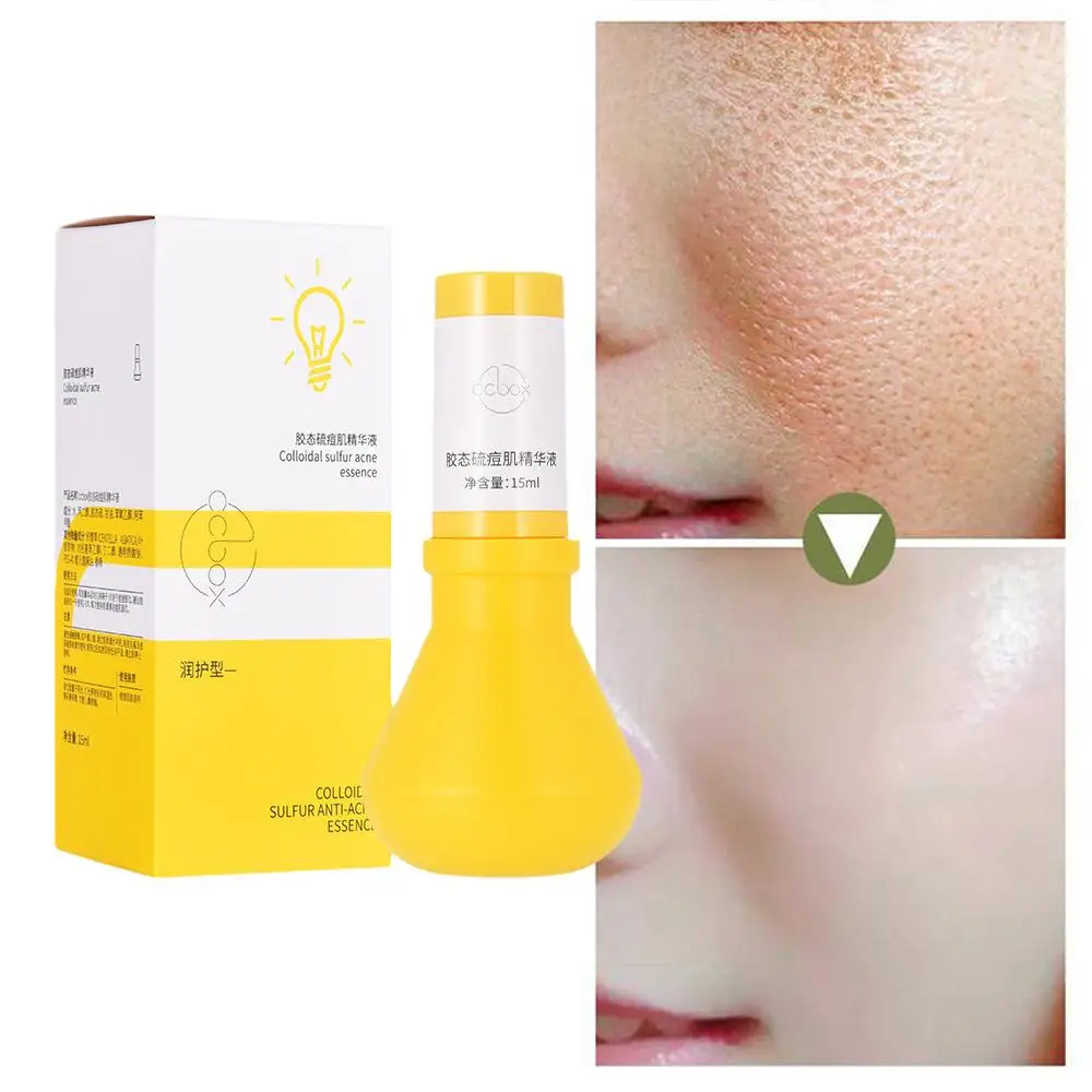 Colloidal Sulphur Acne Skin Essence Removes Acne Blackhead Brightening Smoothing Bulb Pore And Light Large Contractions Fir W7J9
Colloidal Sulphur Acne Skin Essence Removes Acne Blackhead Brightening Smoothing Bulb Pore And Light Large Contractions Fir W7J9