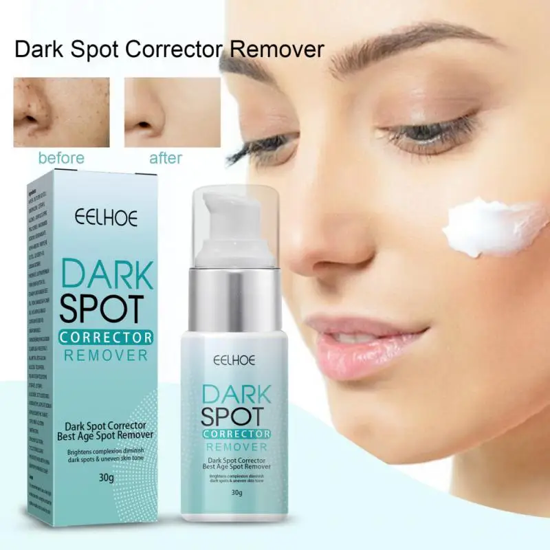 Eelhoe Anti Black Spot Cream Alleviates Facial Melanin Moisturizes And Softens Facial Skin Improves Black Spots Skin Care
Eelhoe Anti Black Spot Cream Alleviates Facial Melanin Moisturizes And Softens Facial Skin Improves Black Spots Skin Care