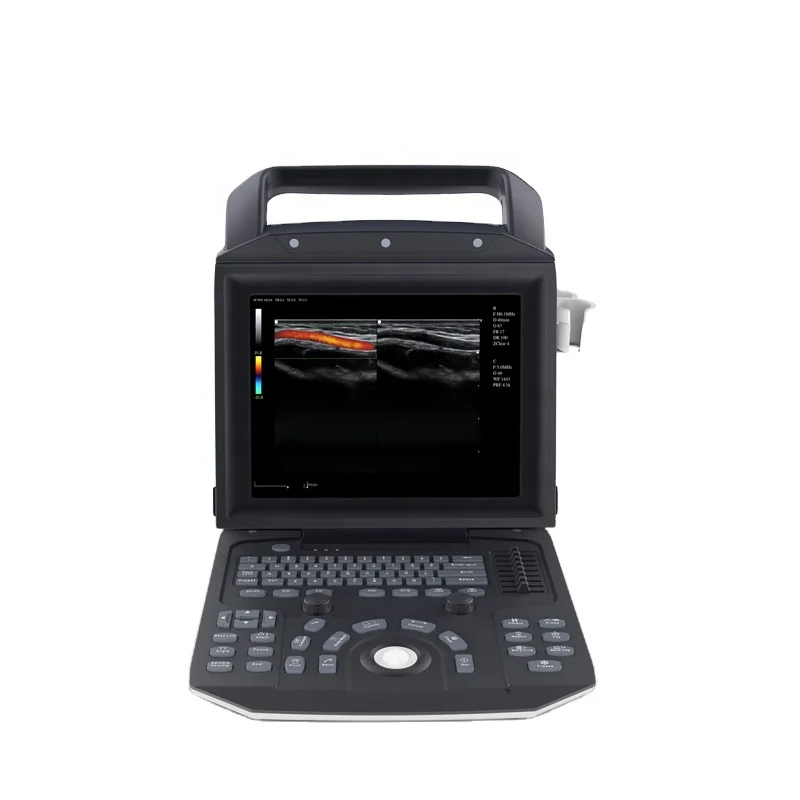 High Efficient New Hospital 4D Portable Color Doppler Ultrasound System Ultrasound Machine Price
High Efficient New Hospital 4D Portable Color Doppler Ultrasound System Ultrasound Machine Price