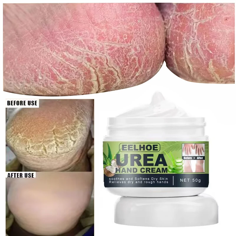 Herbal Anti Crack Foot Cream Heel Cracked Repair Dead Skin Removal Mask Calluses Anti-Drying Hand Feet Moisturizing Skin Care
Herbal Anti Crack Foot Cream Heel Cracked Repair Dead Skin Removal Mask Calluses Anti-Drying Hand Feet Moisturizing Skin Care