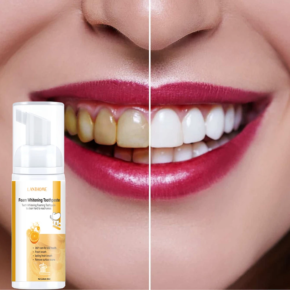 Whitening Teeth Mousse Cleaning Foaming Toothpaste Whitening Stain Removal Improve Tooth Sensitivity Oral Fresh Breath Dental
Whitening Teeth Mousse Cleaning Foaming Toothpaste Whitening Stain Removal Improve Tooth Sensitivity Oral Fresh Breath Dental