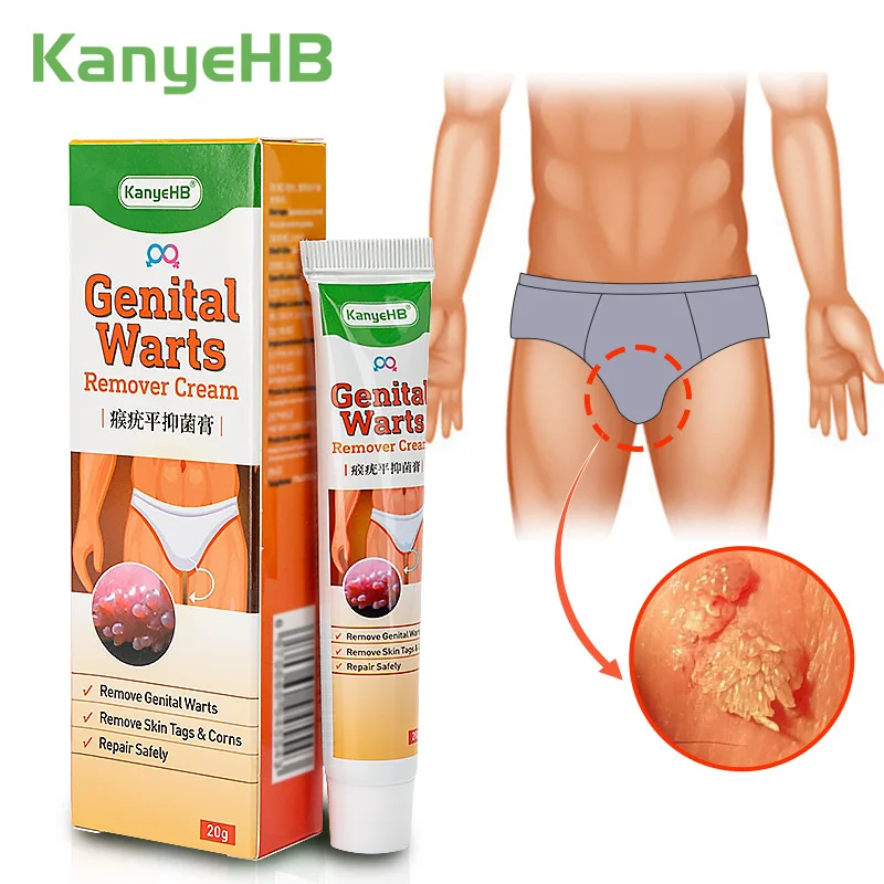 1/2/4PCS Warts Remover Genital Herpes Papillomas Treatment Ointment Antibacterial Ointment Wart Treatment Cream Skin Tag Remover
1/2/4PCS Warts Remover Genital Herpes Papillomas Treatment Ointment Antibacterial Ointment Wart Treatment Cream Skin Tag Remover