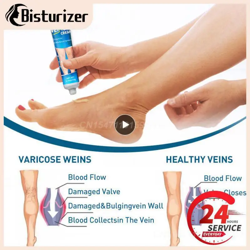 Remove Bruises Removal Body Angiitis Care Effective Varicose Veins Relief Cream Analgesia Improve Blood Circulation Natural
Remove Bruises Removal Body Angiitis Care Effective Varicose Veins Relief Cream Analgesia Improve Blood Circulation Natural