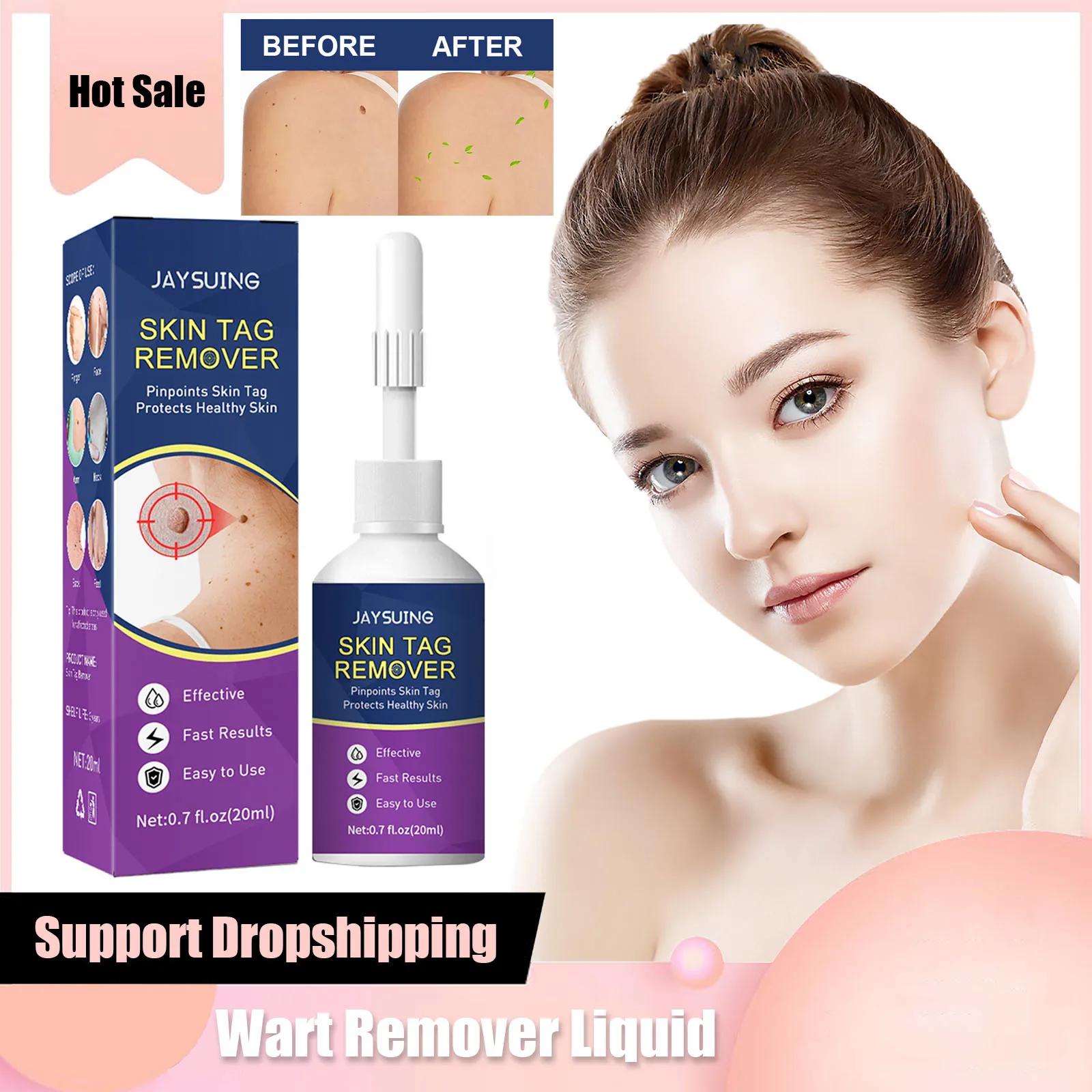 20ml Wart Remover Liquid Skin Tag Fast Remove Anti Foot Corn Papillomas Rapidly Treatment Moles Remover Clearing Liquid
20ml Wart Remover Liquid Skin Tag Fast Remove Anti Foot Corn Papillomas Rapidly Treatment Moles Remover Clearing Liquid