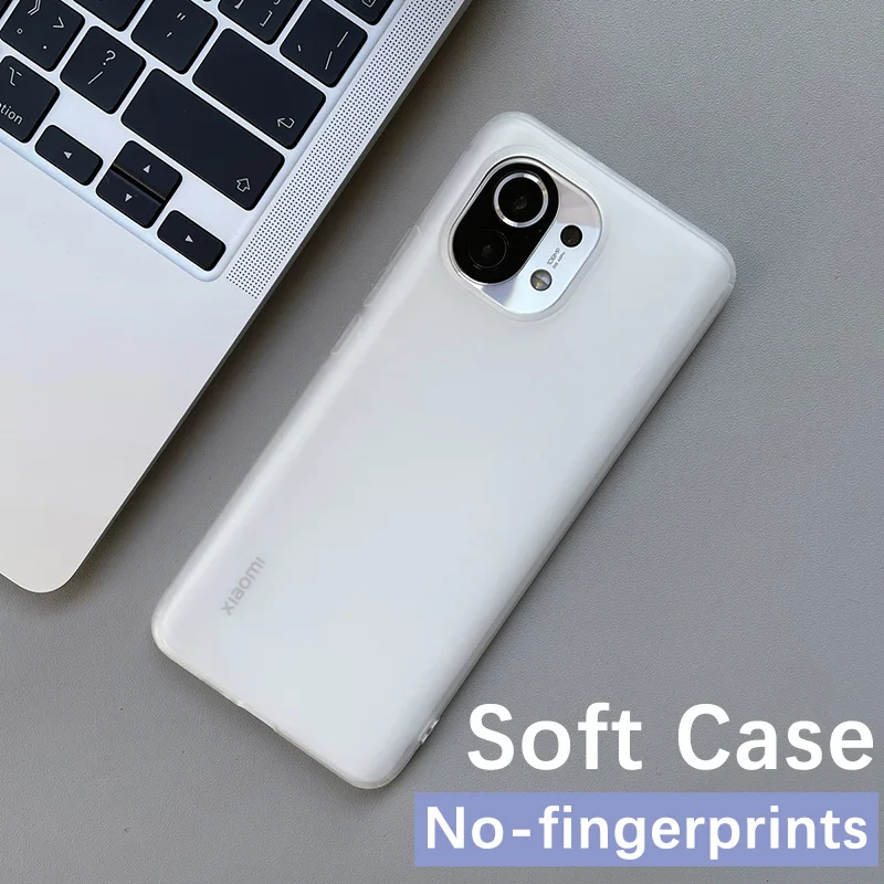 Luxury Matte Silicone Soft Case For Xiaomi Mi 11 10 Ultra 10T 9 Pro Lite Clear Case For Redmi Note 10 9 8 Pro 9 9A 9T 8A POCO F3
Luxury Matte Silicone Soft Case For Xiaomi Mi 11 10 Ultra 10T 9 Pro Lite Clear Case For Redmi Note 10 9 8 Pro 9 9A 9T 8A POCO F3