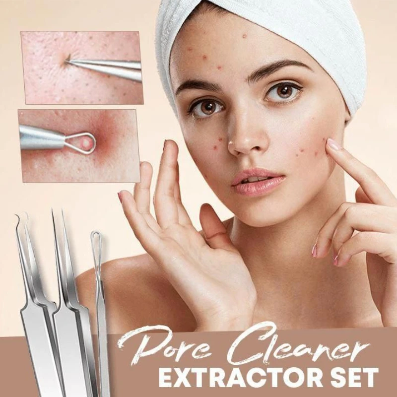 3/1Pc Ultra-fine Cell Pimples Blackhead Clip Tweezers Beauty Face Skin Care Special Scraping & Closing Artifact Acne Needle Tool
3/1Pc Ultra-fine Cell Pimples Blackhead Clip Tweezers Beauty Face Skin Care Special Scraping & Closing Artifact Acne Needle Tool