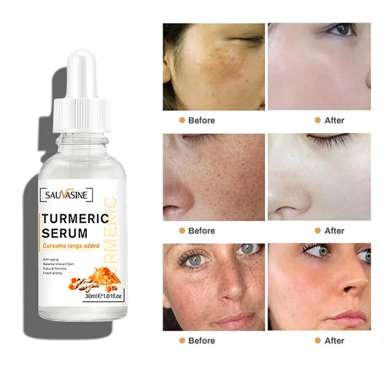 Сыворотка куркума для удаления темных точек, средство для удаления акне, яркий корректор кожи, эссенция для лица для улучшения осветления м...
Сыворотка куркума для удаления темных точек, средство для удаления акне, яркий корректор кожи, эссенция для лица для улучшения осветления м...