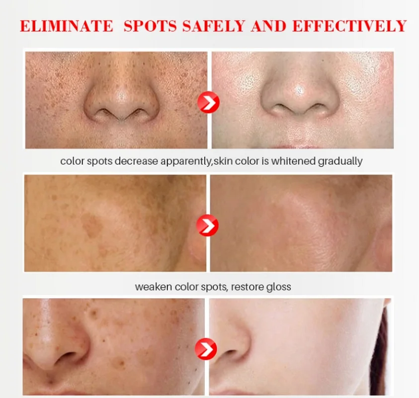 2.5%Retinol Complex Improve Skin Texture Tone Anti Aging Wrinkles Enlarged Pores Smooth Hydrate Skin Face Retinol Whitening Oil 
2.5%Retinol Complex Improve Skin Texture Tone Anti Aging Wrinkles Enlarged Pores Smooth Hydrate Skin Face Retinol Whitening Oil
