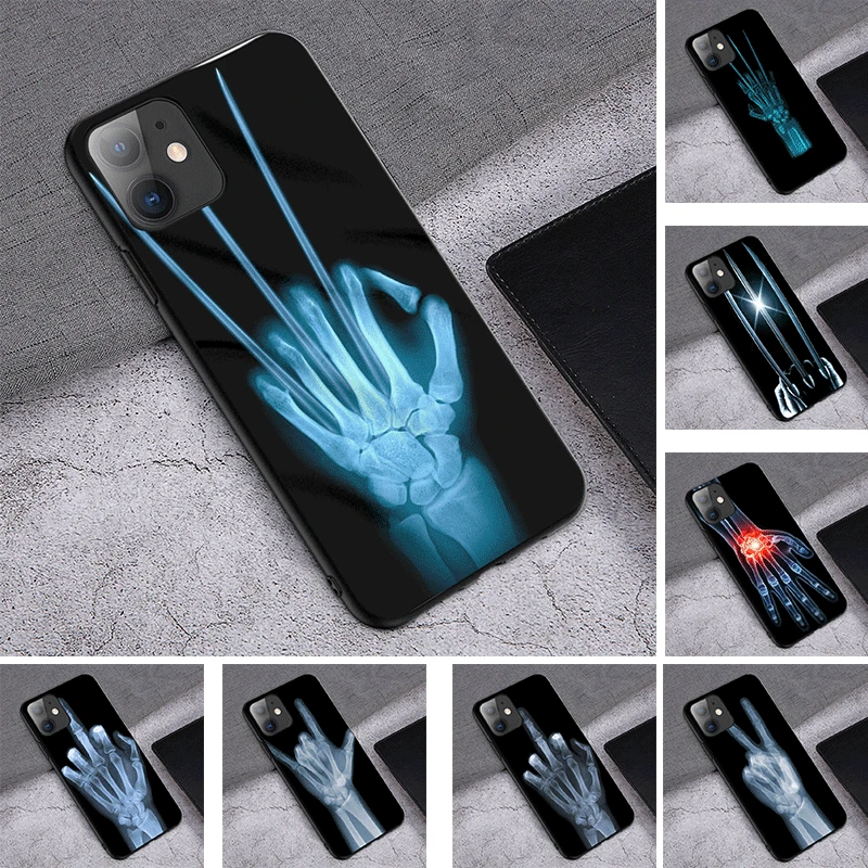soft TPU Phone Case For Xiaomi Redmi note 11 11T POCO M4 Pro 11S 5G 9T 10X 9 Cover Cute Wolverine X-ray Hand Bones
soft TPU Phone Case For Xiaomi Redmi note 11 11T POCO M4 Pro 11S 5G 9T 10X 9 Cover Cute Wolverine X-ray Hand Bones