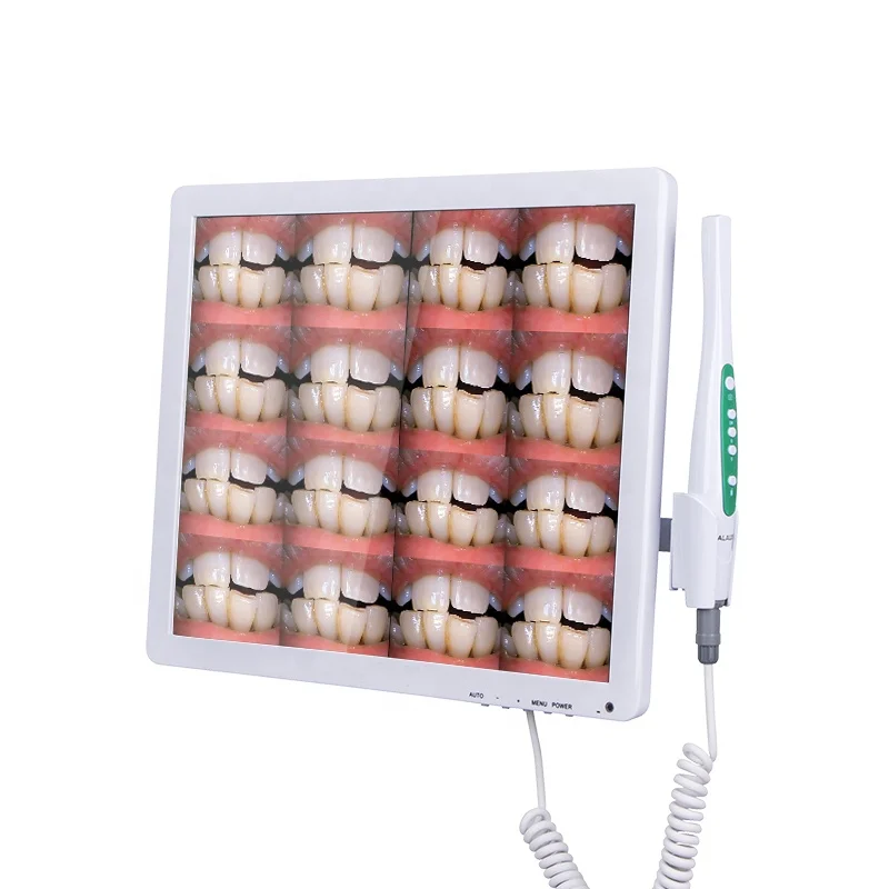 Factory Price Dental Equipment HD Quality Display Intra Oral Monitor Intraoral Camera With 6 LED Light Sources
Factory Price Dental Equipment HD Quality Display Intra Oral Monitor Intraoral Camera With 6 LED Light Sources