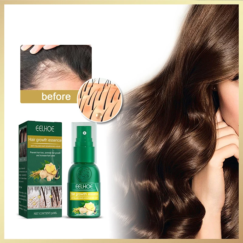 Sdattor Ginger Sprays для роста волос, натуральная Сыворотка против выпадения волос, предотвращающая облысение, быстрое питание
Sdattor Ginger Sprays для роста волос, натуральная Сыворотка против выпадения волос, предотвращающая облысение, быстрое питание