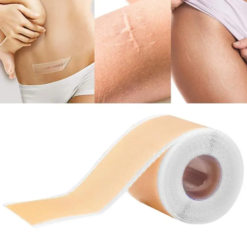 

Silicone Scar Sheet 1.57 X 59.06 Inch Scar Sheet Soft Silicone Gel Tape For Scar Removal Scar Away Patch Scar Sheets Keloid Bump