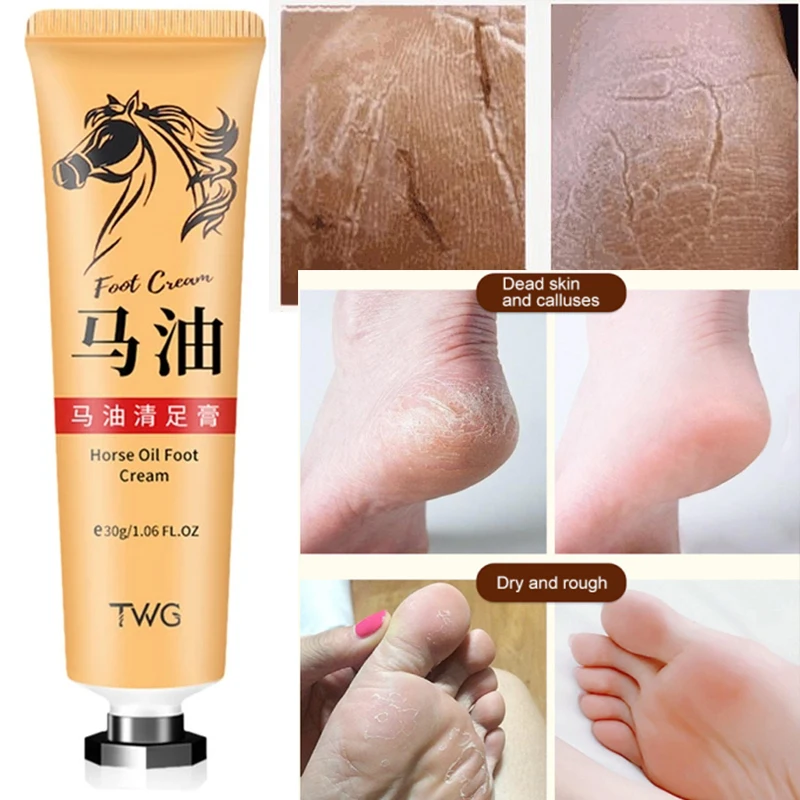 Anti-Crack Foot Cream Alleviate Roughness Moisturize Skin Horse Oil Cream Effectively Treats Dry and Cracked Skin Hand Feet Care
Anti-Crack Foot Cream Alleviate Roughness Moisturize Skin Horse Oil Cream Effectively Treats Dry and Cracked Skin Hand Feet Care