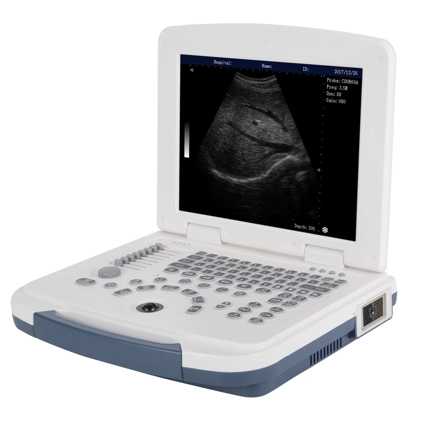 Medical equipment ultrasound laptop usg portable SYSTEM ultrasound scanner handheld machine portable scan price China Instrument
Medical equipment ultrasound laptop usg portable SYSTEM ultrasound scanner handheld machine portable scan price China Instrument