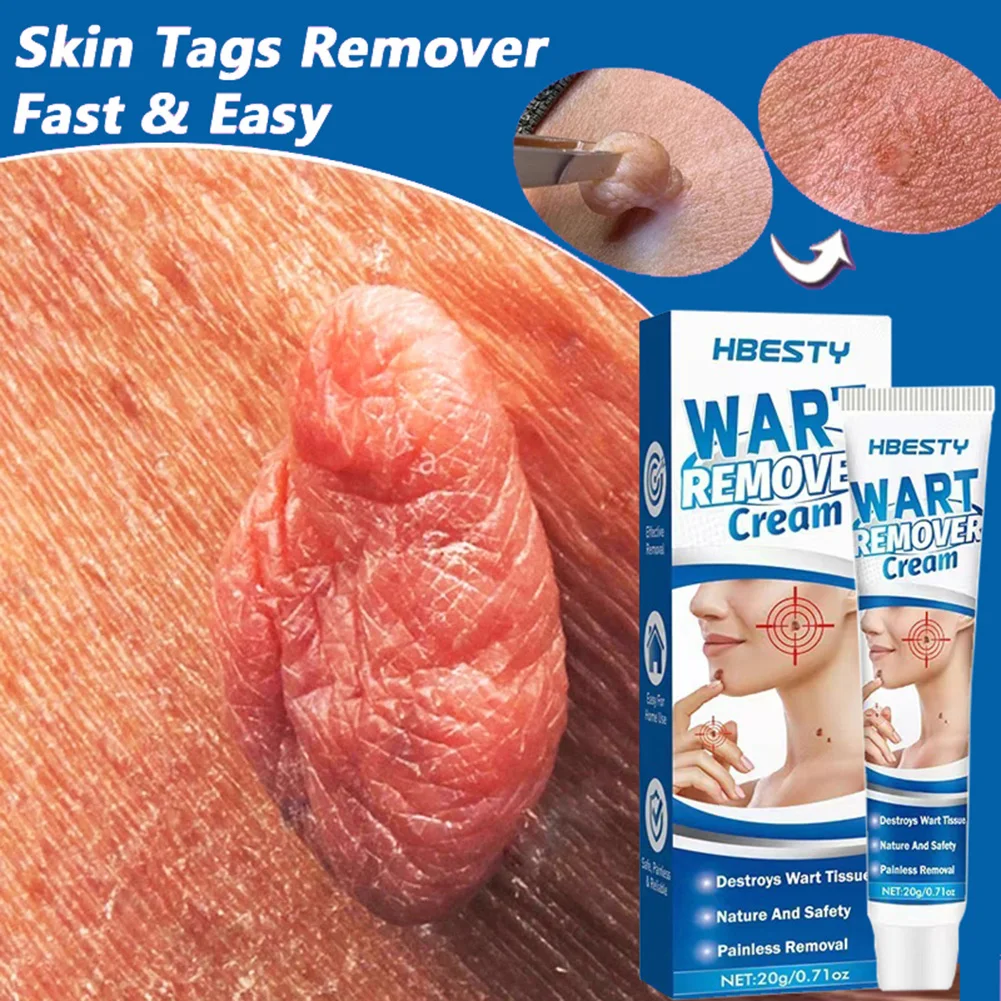 Skin Tag Remover Cream Painless Mole Skin Dark Spot Warts Remover Serum Freckle Face Wart Tag Treatment Removal Essential Oil
Skin Tag Remover Cream Painless Mole Skin Dark Spot Warts Remover Serum Freckle Face Wart Tag Treatment Removal Essential Oil