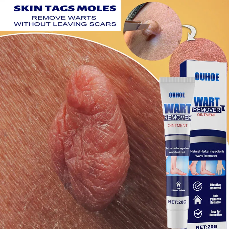 Skin Tag Remover Cream Painless Treatment Mole Dark Spot Genital Wart Antibacterial Ointment Herbal Extract Body Care Products
Skin Tag Remover Cream Painless Treatment Mole Dark Spot Genital Wart Antibacterial Ointment Herbal Extract Body Care Products