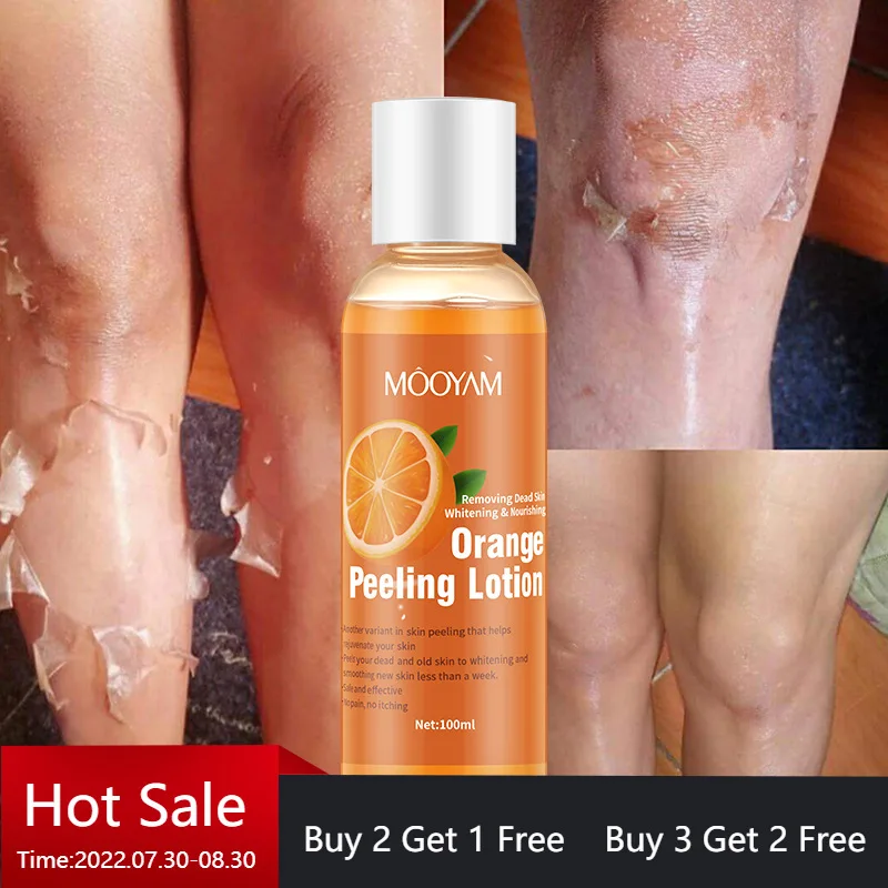 Orange Peel Gentle Exfoliating Body Whitening Lotion Bleaching Dark Skin Spots Blackhead Blemishes Dead Skin Treatment Care
Orange Peel Gentle Exfoliating Body Whitening Lotion Bleaching Dark Skin Spots Blackhead Blemishes Dead Skin Treatment Care