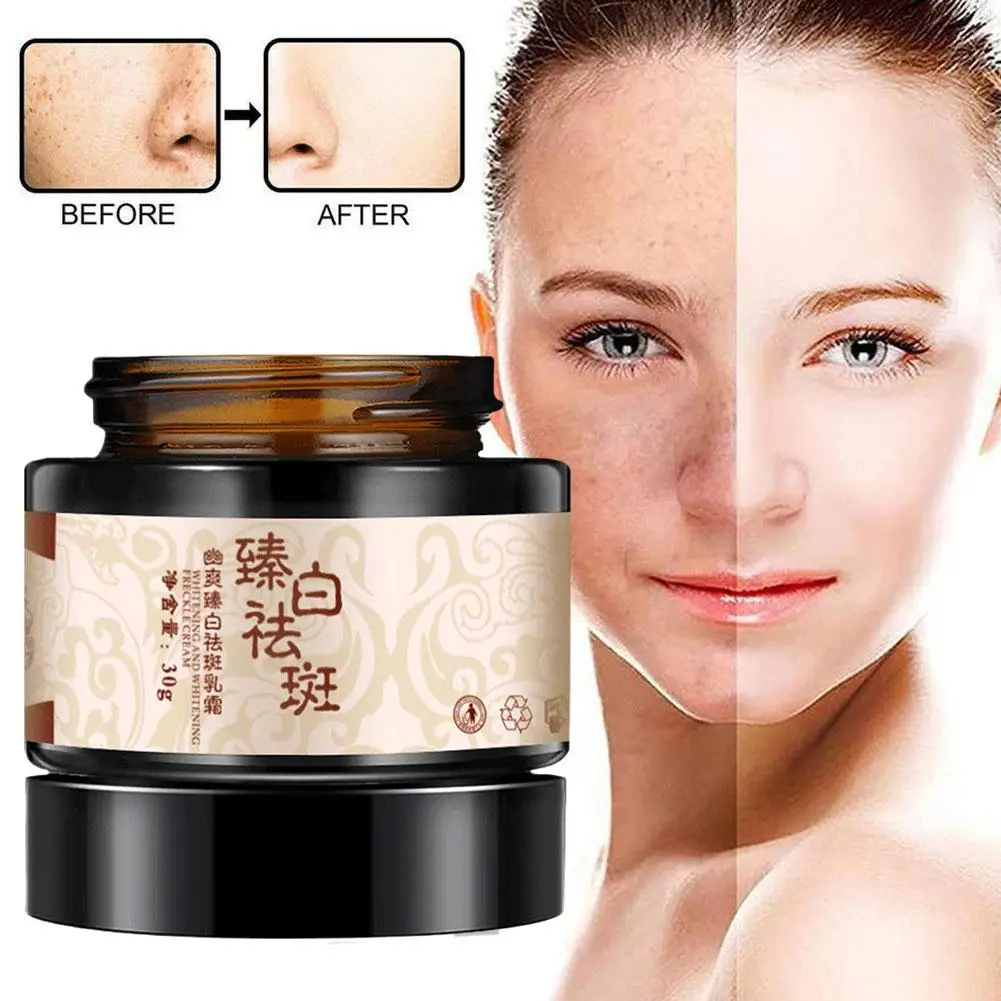 

Powerful Whitening Freckle Cream Plant Face Cream Remove Freckles Dark Spots 30g For Skin Whitening L5I5
