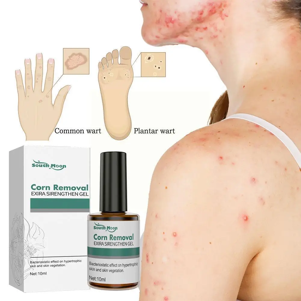 Mole Wart Skin Tag Remover Liquid Painless Face Black Filamentous Dots Cosmetic Remover Skin Verruca Care Removal Serum Q2w8
Mole Wart Skin Tag Remover Liquid Painless Face Black Filamentous Dots Cosmetic Remover Skin Verruca Care Removal Serum Q2w8