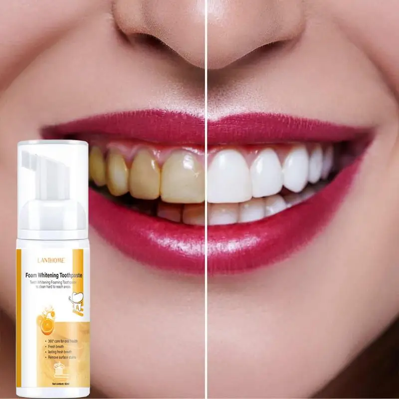 Teeth Cleansing Whitening Mousse 50ml Deep Stain Removal Teeth Whitening Staining Color Correction Toothpaste Oral Hygiene Foam
Teeth Cleansing Whitening Mousse 50ml Deep Stain Removal Teeth Whitening Staining Color Correction Toothpaste Oral Hygiene Foam