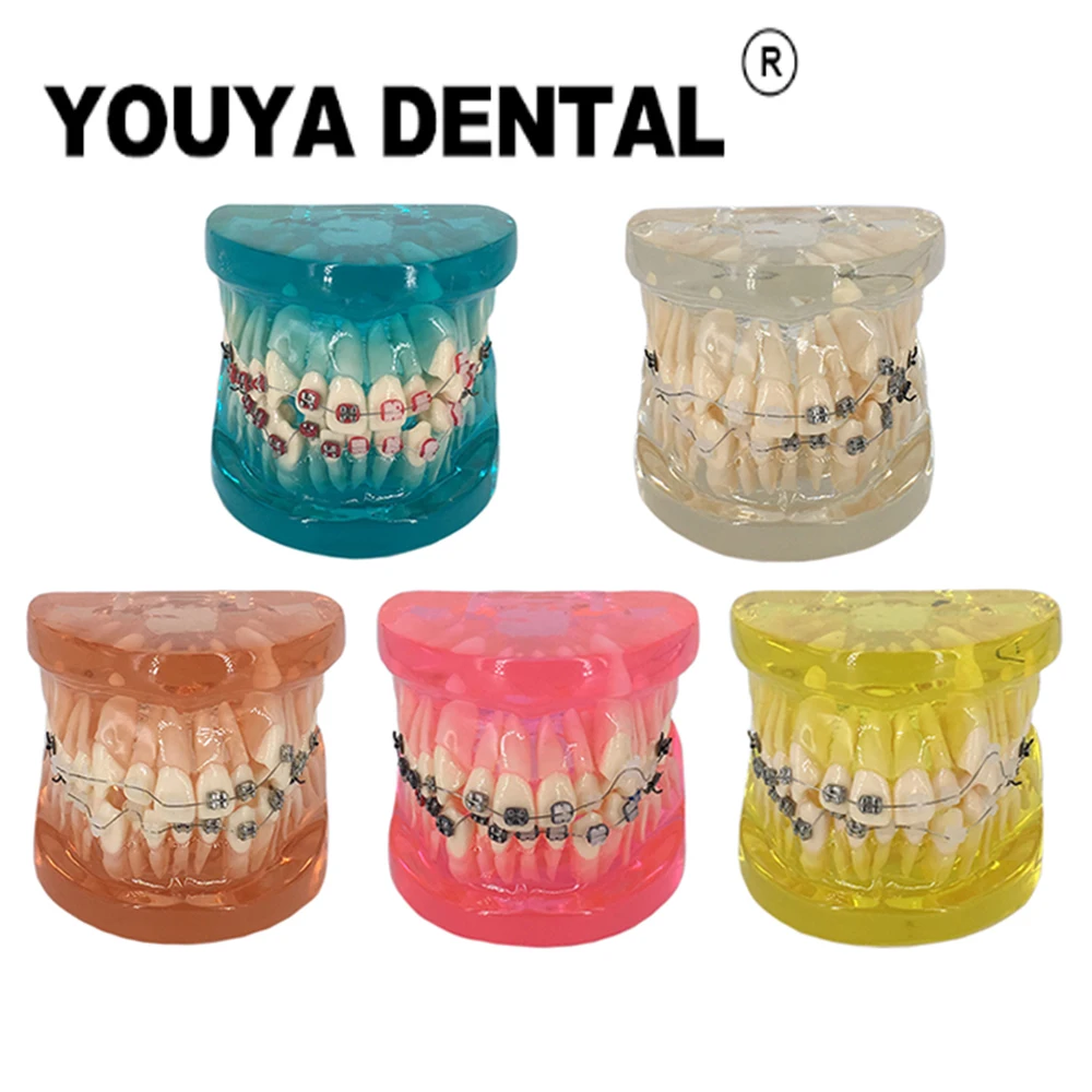 Wrong Jaw Half Metal Half Ceramic Orthodontic Model Dental Teeth Model For Dentist Student Studying Teaching Demonstration Tool
Wrong Jaw Half Metal Half Ceramic Orthodontic Model Dental Teeth Model For Dentist Student Studying Teaching Demonstration Tool