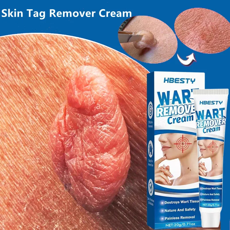 Skin Tag Remover Cream Painless Mole Skin Dark Spot Warts Remover Serum Freckle Face Wart Tag Treatment Removal Essential Oil
Skin Tag Remover Cream Painless Mole Skin Dark Spot Warts Remover Serum Freckle Face Wart Tag Treatment Removal Essential Oil