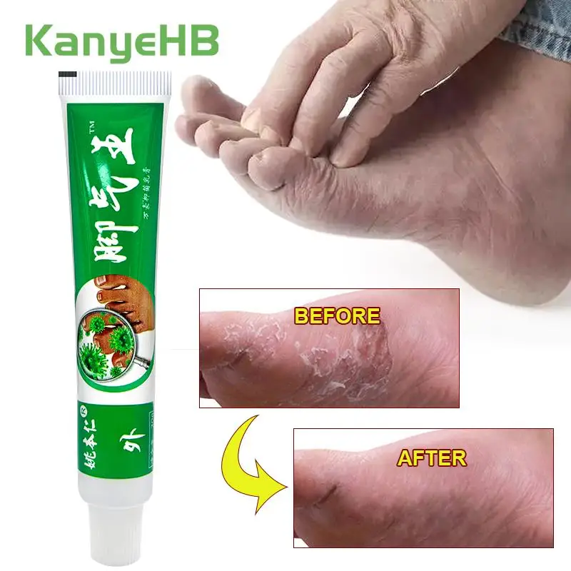 1Pcs Foot Odor Cream Antibacterials Deodorant Herb Anti Itch Sweat Odor Athlete's Foot Ointment Anti-Fungi Peeling Erosion S053
1Pcs Foot Odor Cream Antibacterials Deodorant Herb Anti Itch Sweat Odor Athlete's Foot Ointment Anti-Fungi Peeling Erosion S053
