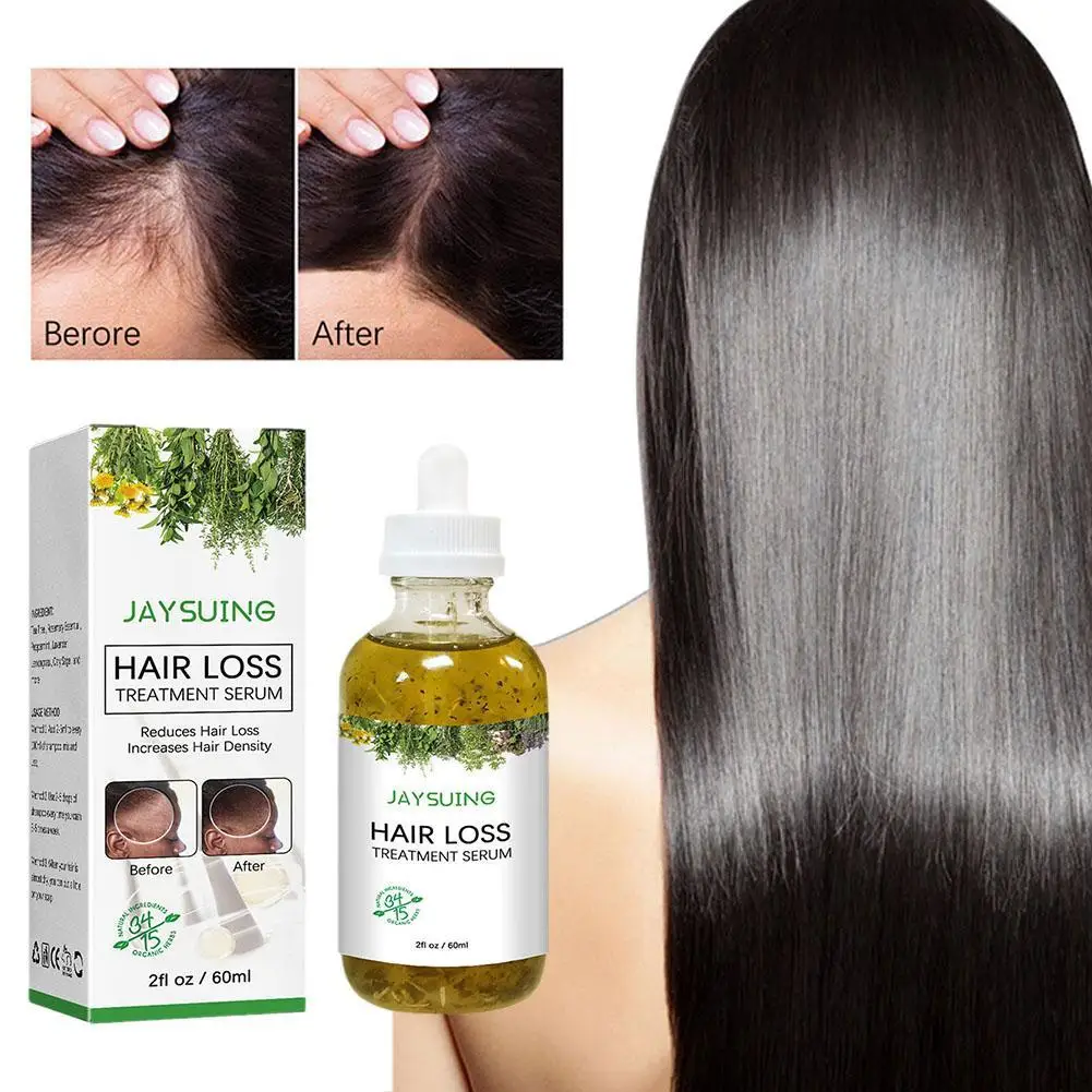 Hair Loss Treatment Shampoo Anti-itch Anti Dandruff Oil Control Serum Oil Scalp Root Thicker Fast Regrowth Essence
Hair Loss Treatment Shampoo Anti-itch Anti Dandruff Oil Control Serum Oil Scalp Root Thicker Fast Regrowth Essence