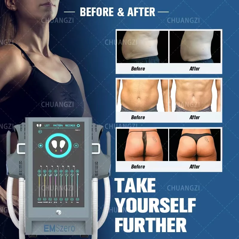 4-handle Tesla Hi-Emt Emslim electromagnetic muscle stimulation device with radio frequency for fat reduction E
4-handle Tesla Hi-Emt Emslim electromagnetic muscle stimulation device with radio frequency for fat reduction E