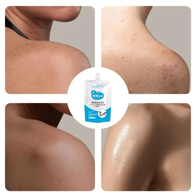 200g Instant Whitening Body Exfoliating Nicotinamide Gel Body Mud Scrub Scrub Treasure Cream Mud Rubbing Exfoliator N5F9
200g Instant Whitening Body Exfoliating Nicotinamide Gel Body Mud Scrub Scrub Treasure Cream Mud Rubbing Exfoliator N5F9