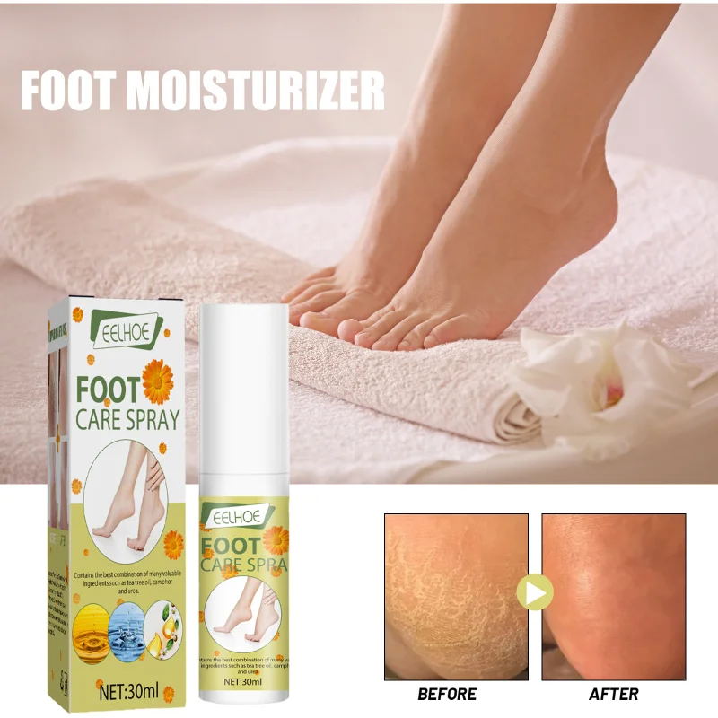 

Foot Care Spray Moisturizing exfoliating Anti peeling dry crack Heel Cracked dead skin Removal calluses rejuvenation feet repair