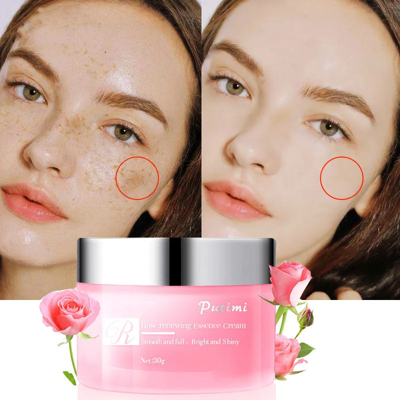 Whitening Freckles Face Cream Effective Remove Melasma Dark Spots Fade Acne Scars Melanin Moisturizing Brighten Firm Skin Care
Whitening Freckles Face Cream Effective Remove Melasma Dark Spots Fade Acne Scars Melanin Moisturizing Brighten Firm Skin Care